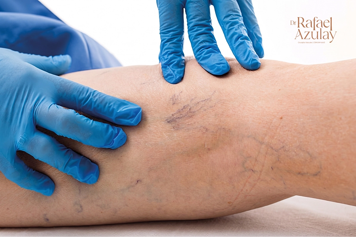 medico vascular varizes manaus